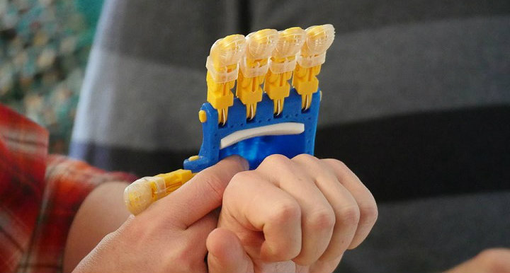 3D printing prosthetics